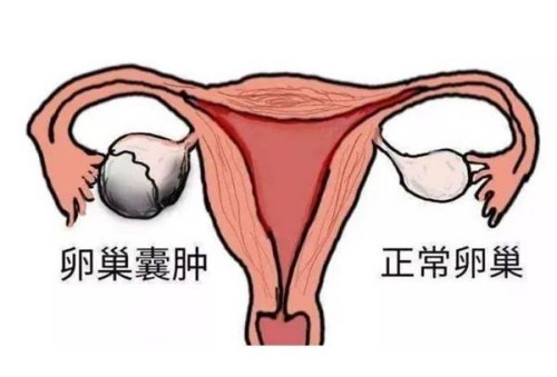 孕期外阴白斑会传染给胎儿吗,外阴白斑怎么护理