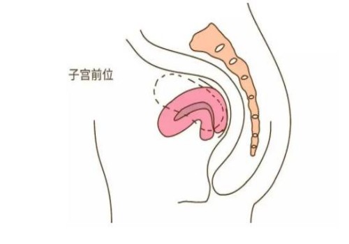 11号染色体倒位对胎儿的影响很大，附11号染色体倒位的症状